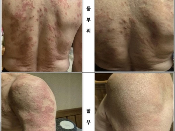 일상 속 외부 자극으로 건조해진 바디 피부, 5일간의 집중 웰니스 컨디션 케어 기록